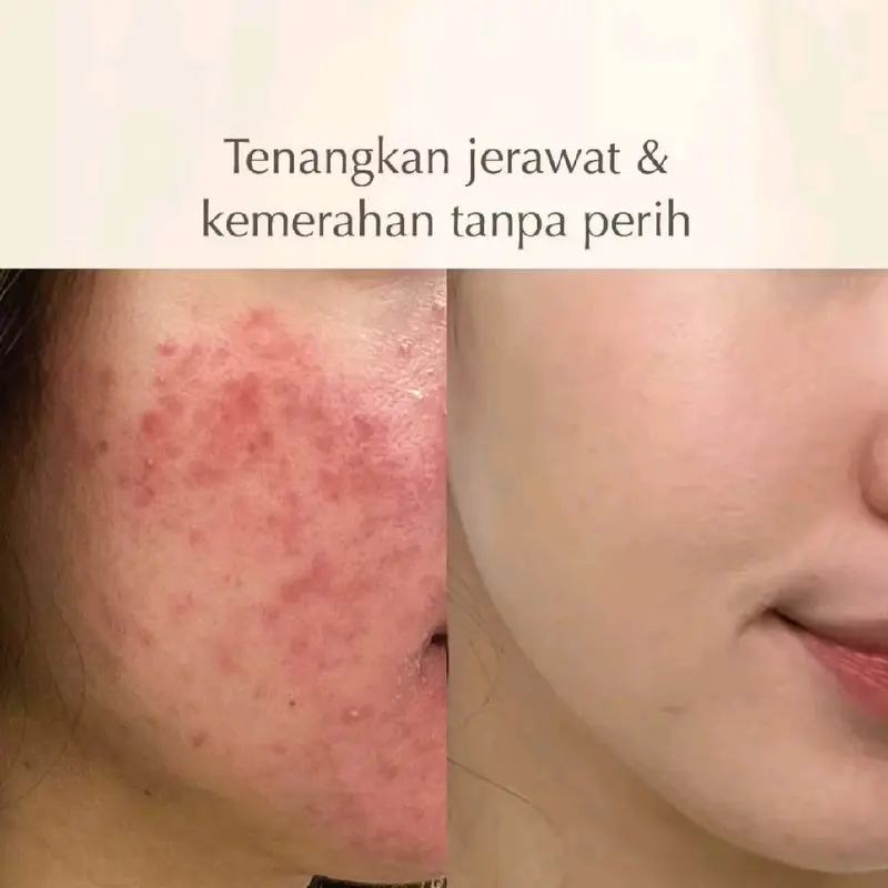 POLYNIA |Pomegrante revitalizing botox mask | Orange Brightening | pickly pear Hydrating | shiconix soothing mask 4