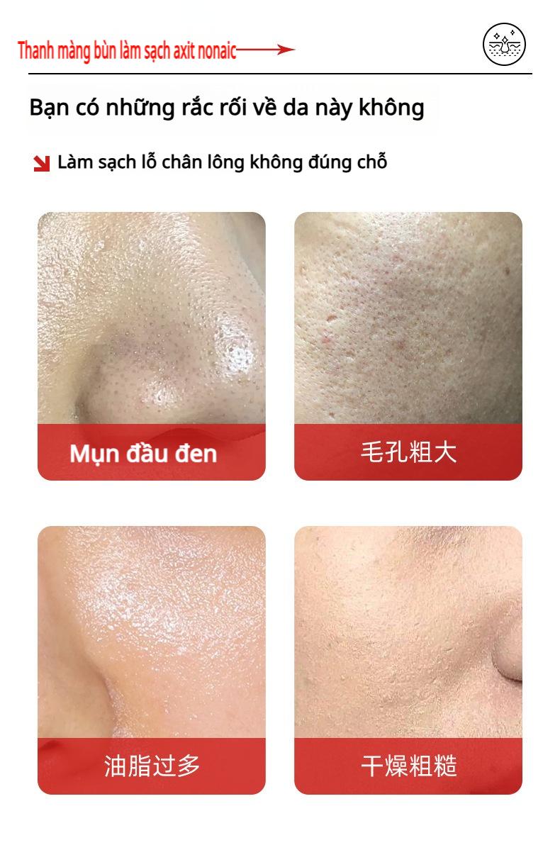Product Introduction of [Ưu đãi bộ 2 chai]Thanh mặt nạ bùn Baisu 40g – Chứa axit azelaic, làm sạch sâu, se khít lỗ chân lông, loại bỏ mụn đầu đen & kiểm soát dầu 1