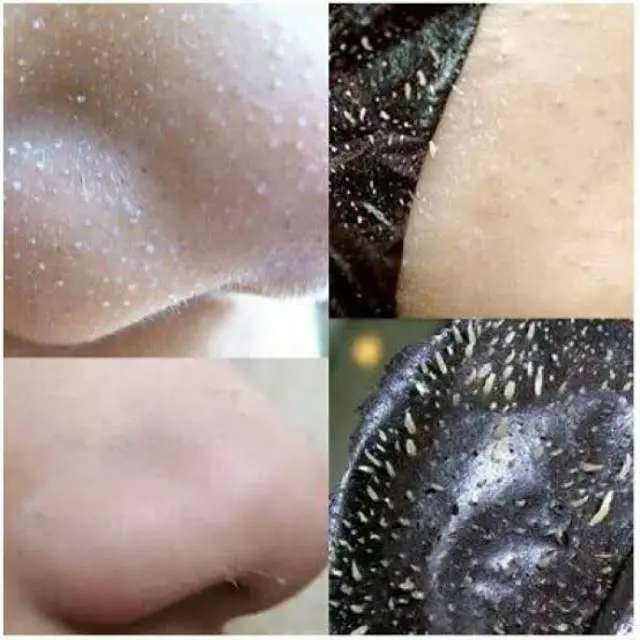 DS Bubuk Gelatin Masker Komedo Semua Jenis Kulit Kering 3