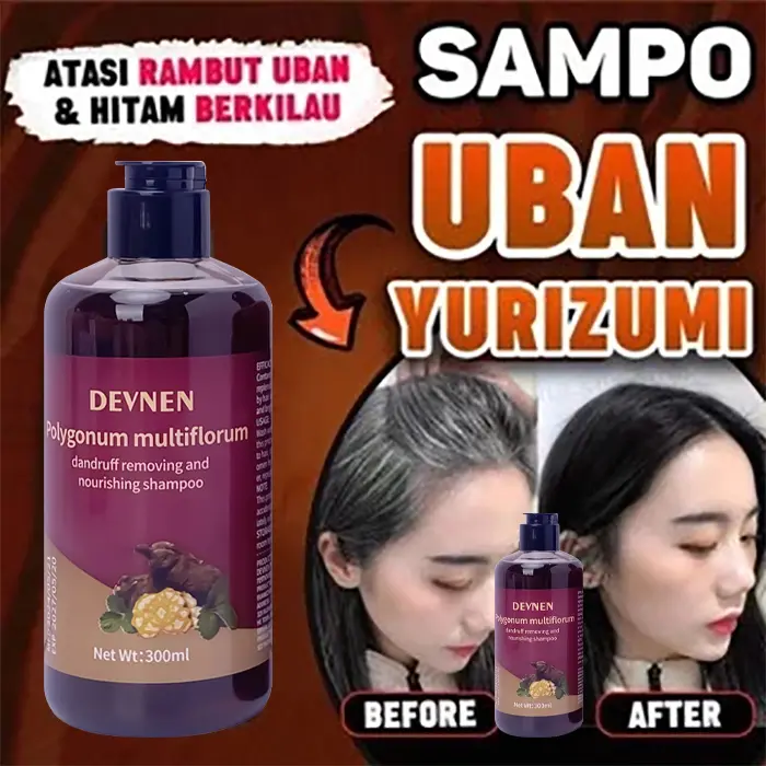 SHAMPO Black Herbal Natural Penyamar Rambut dan Penghiang uban Usia Muda 300ml Shampoo Herbal Polygonum Penghitam Rambut Hitam Dalam Sampo Ketombe Sampo Menghitamkan  Conditioner 5