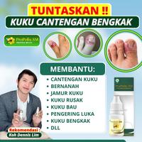 Gambar Propolis Sm Untuk Cantengan Kaki Jempol Bengkak Parah Kuku Rusak Herbal Isi 6ml PALING AMPUH NAMUN SETIAP ORANG HASILNYA BERBEDA - PSM 1 BOTOL dari Mugiherbal Kota Administrasi Jakarta Barat 1 Tokopedia