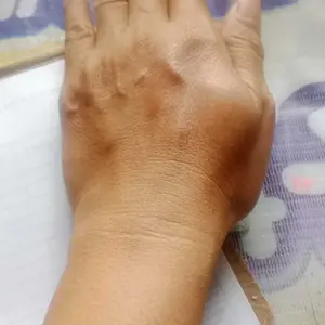 [BUNDLING] Paket Bundling Super Hemat Mencerahkan Mengexsfoliasi- Lotion Exsfoliasi 10x Pencerah Siang Malam + Toner Badan