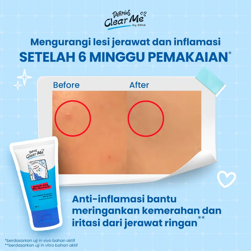 DERMIES Clear Me Acne Smooth Sunscreen SPF 30 PA++ 30g - Sunscreen Wajah Berjerawat 2