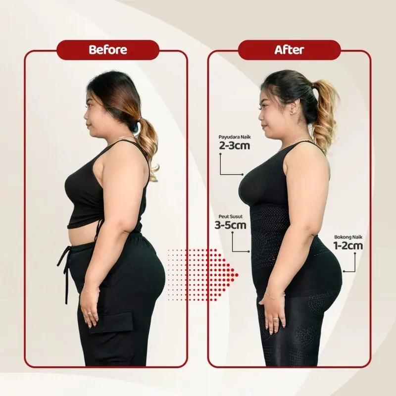 Korset Wanita Korset Kozuii Slimming Suit Membantu Pasca Melahirkan 1