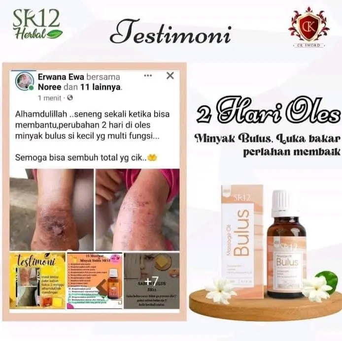 MINYAK BULUS SR12 / HERBAL ORY BPOM / PENGHILANG SEGALA MACAM BEKAS 4