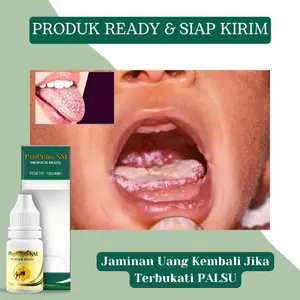 Cairan Untuk Kandidiasis Mukokutan, Lidah Berjamur, Pembersih Lidah Putih, Lidah Mati Rasa, Lidah Kebas, Lidah Perih, Penghilang Bercak Putih Di Lidah, Leukoplakia, Lidah Anak Putih, Sariawan, Infeksi Jamur Dengan Propolis SM