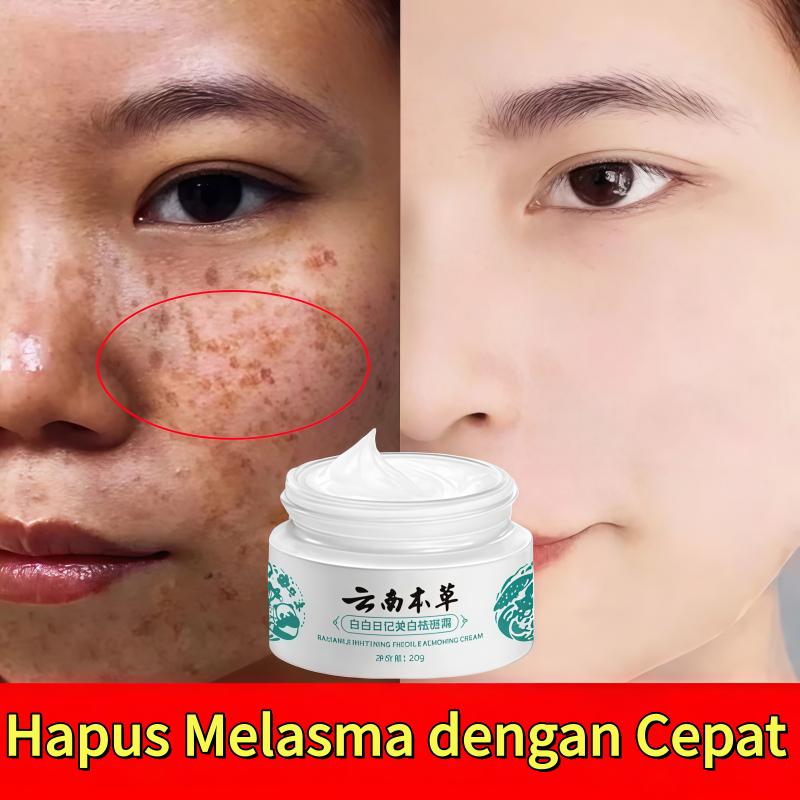Cream penghilang flek hitam Krim pemutih Penghilang flek Menghilangkan Flek Hitam di Wajah Yunnan Herbal Whitening Freckle Salep - Beli 2 gratis 1