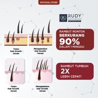 Gambar Rudy Hadisuwarno Cosmetics Hair Growth Serum 30 ml Hair Serum Penumbuh Rambut Mengurangi Rambut Rontok dari Martha Tilaar Shop_NEW Kota Administrasi Jakarta Timur 3 Tokopedia