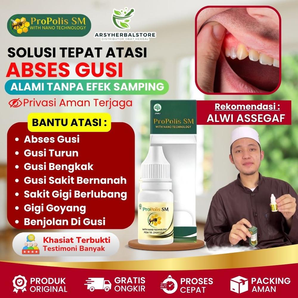 Propolis SM Atasi Abses Gusi, Gusi Bernanah Radang, Nyeri Gusi, Gusi Bengkak, Gusi Turun, Benjolan Di Gusi