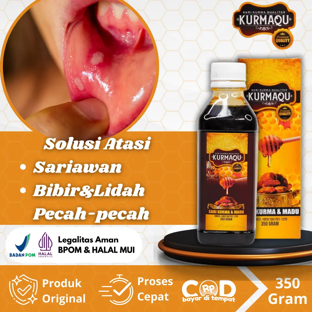 Untuk Sariawan Mulut, Lidah, dan Bibir, Bibir dan Lidah Pecah-Pecah Dengan Kurmaqu sari kurma Bau  Gusi Kumur madu herbal alami