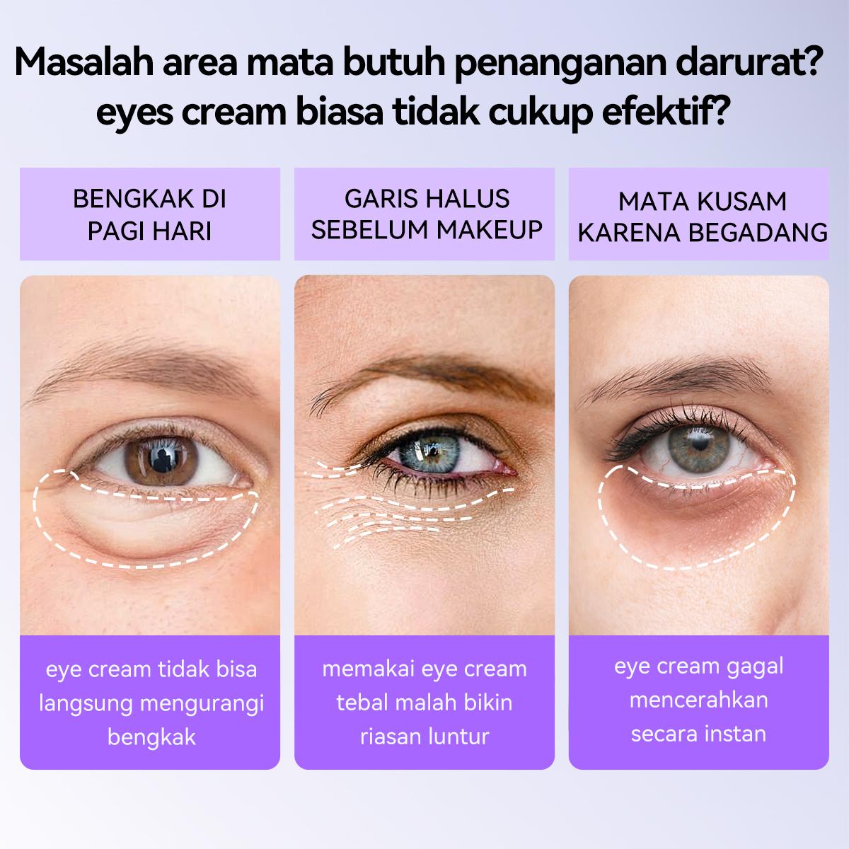 [HOT][BPOM] LANBENA Retinol Eye Patches 60Pcs | 5X Anti-Aging SGS Tested | 15 Menit Kurangi Garis Halus & Lingkaran Hitam | Gel Biomimetik Dingin Mata Bengkak Kantung Mata Anti Kerut