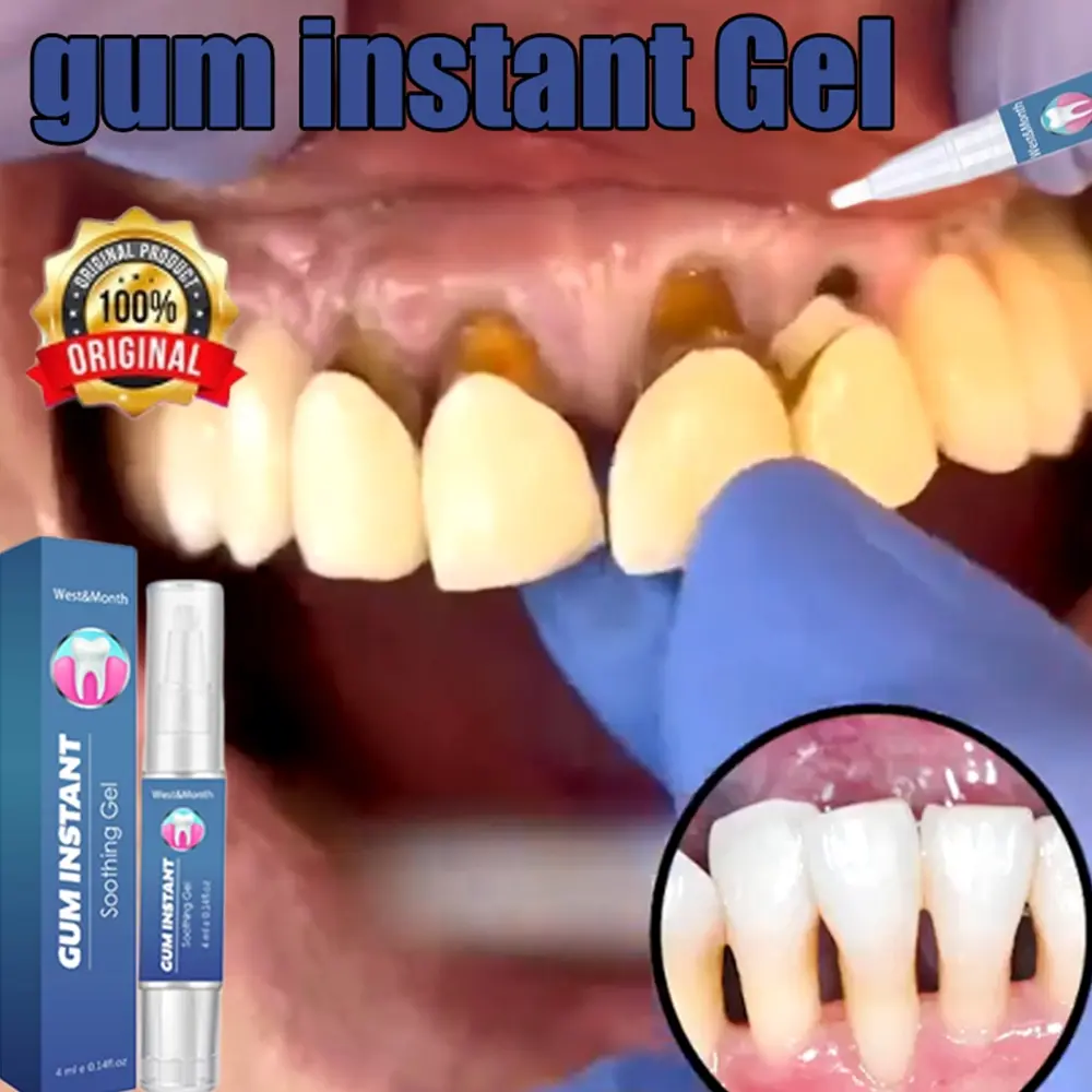 penguat gigi goyang gum instant untuk gigi gum care Gel obat gusi penghilang gusi Penguat gigi Penguat gigi tambal gigi Penghilang karang gigi