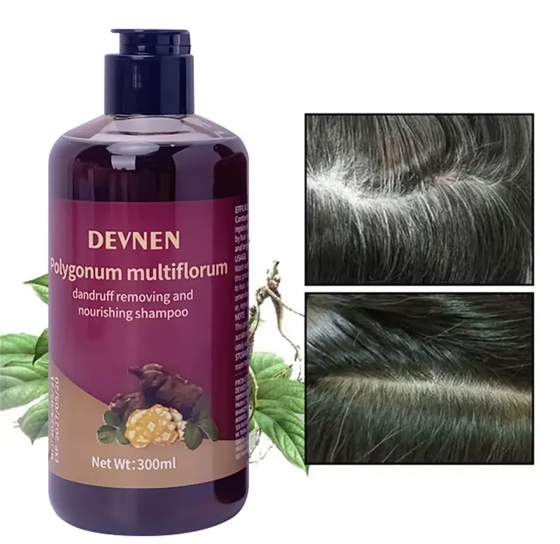 SHAMPO Black Herbal Natural Penyamar Rambut dan Penghiang uban Usia Muda 300ml Shampoo Herbal Polygonum Penghitam Rambut Hitam Dalam Sampo Ketombe Sampo Menghitamkan  Conditioner 3