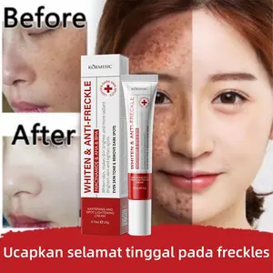 BPOM Krim Penghilang Flek Hitam 20g Nicotinamide Whitening Freckle Cream Remove Dark Spots Brightening Moisturizing,Whitening Salep Pemutih & Pemudar Flek Bintik Wajah Whitening Freckle Cream Pencerah Wajah,Niacin Dark Spots Removal Brightening