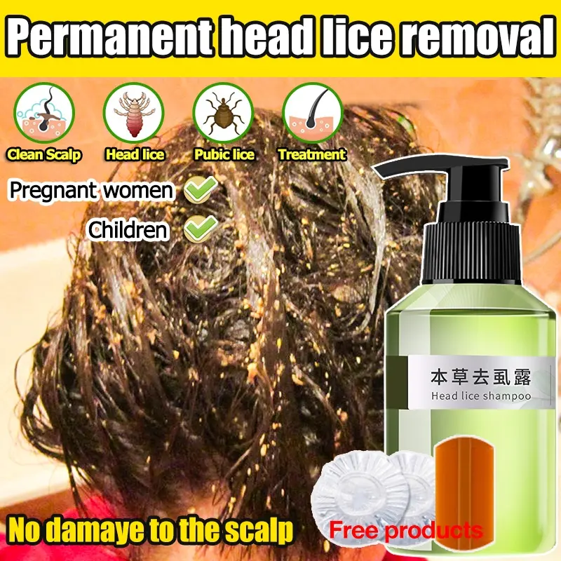 Lice Treatment Shampoo for Kids 100ml Lice Removing Shampoo with Bai Bu Ding for Effective Head Lice and Egg Removal Safe for Children Gentle Formula Head Lice Solution