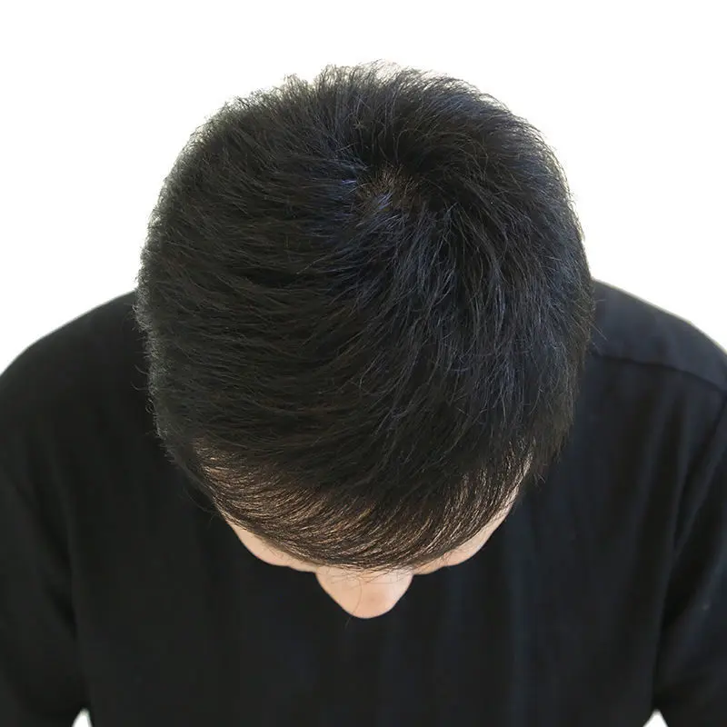 Men with wigs Head hair patch A bald head in the Mediterranean, covering white hair Natural breathable hair repair top