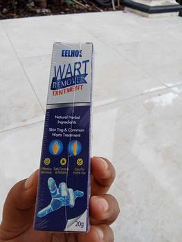 Product Review of Penghilang Kutil Wart Remover Skin Tag Remover Penghilang Tahi lalat Salep Penghilang Flek Hitam Perawatan from s**l 0