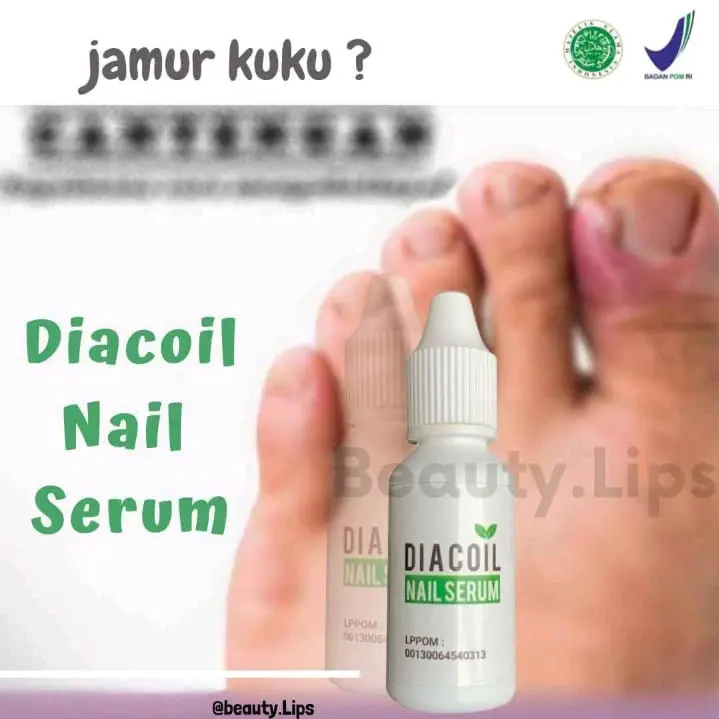 Diacoil Nail Serum Mengatasi Kuku berjamur, Cantengan Dan Nutrisi Kuku. 0
