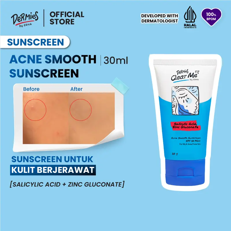 DERMIES Clear Me Acne Smooth Sunscreen SPF 30 PA++ 30g - Sunscreen Wajah Berjerawat 1