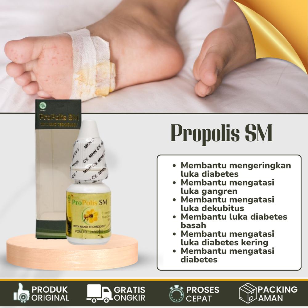 Cairan Oles Pengering Luka Diabetes Basah Kering Gangren Propolis SM - Propolis SM