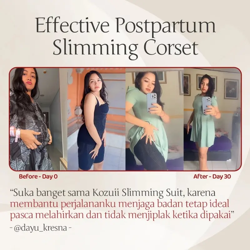 Korset Wanita Korset Kozuii Slimming Suit Membantu Pasca Melahirkan 3