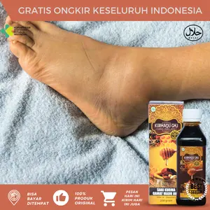 Jamu Pengempes Kaki Bengkak Sebelah Madu Buat Kaki Bengkak Aman Untuk Ibu Hamil Menyusui Herbal Alami Sari Kurma Kurmaqu Asli Original