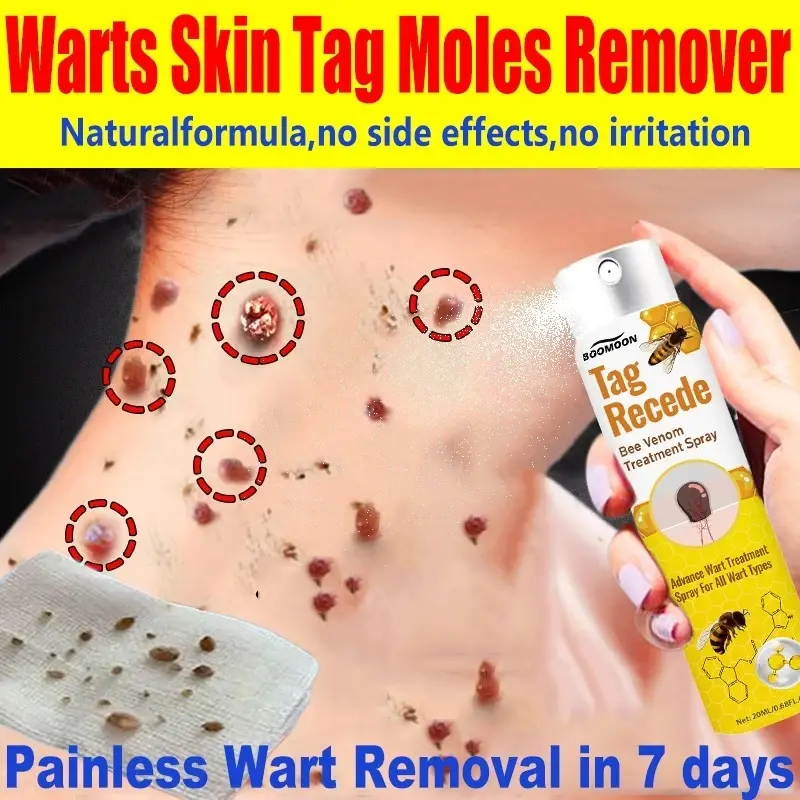 Penghilang tahi lalat di wajah Penghilang kutil di leher Wart removal Tag recede Penghilang Kutil Dan Tahi Lalat Obat Kutil Paling Ampuh Skin tag remover Bee venom treatment spray