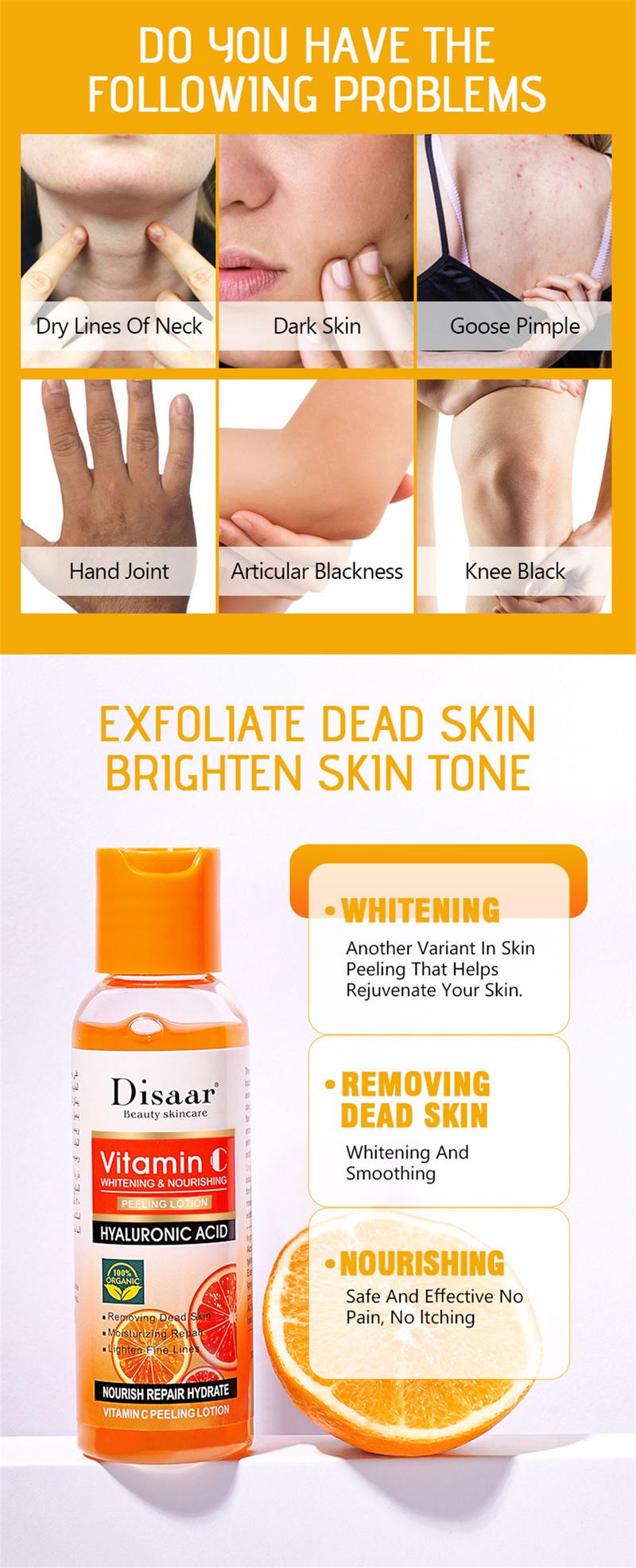 Product Introduction of Vitamin C Peeling Lotion Remove Dead Skin Exfoliating Whitening and Smoothing New Skin Body Skincare Product Exfoliating Lotion Whitens Brightens And Lightens Melanin Scrubs Exfoliates And Moisturizes The Body Body Care Skin Care For Women Men 3