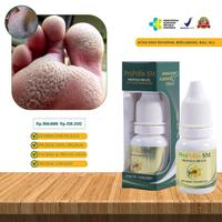 Gambar Propolis Sm Atasi kaki rayapan Pitted Keratolysis, Telapak kaki berlubang bolong dan bau Gatal dari Zubair Healty Kota Administrasi Jakarta Pusat 1 Tokopedia