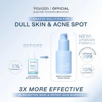 Gambar Promo Paket Bundle Lightening Dry II Small Size (Micellar Gentle Wash 50ml, Day Cream & Night Cream 20ml, Toner 125ml, Serum symradiance 30ml) dari Wardah Beauty Sumatra Kota Pekanbaru 2 Tokopedia