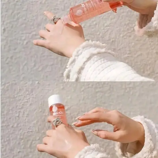 BIO OIL PENGHILANG BEKAS LUKA&JERAWAT / MELEMBABKAN WAJAH KERING UNTUK PRIA WANITA