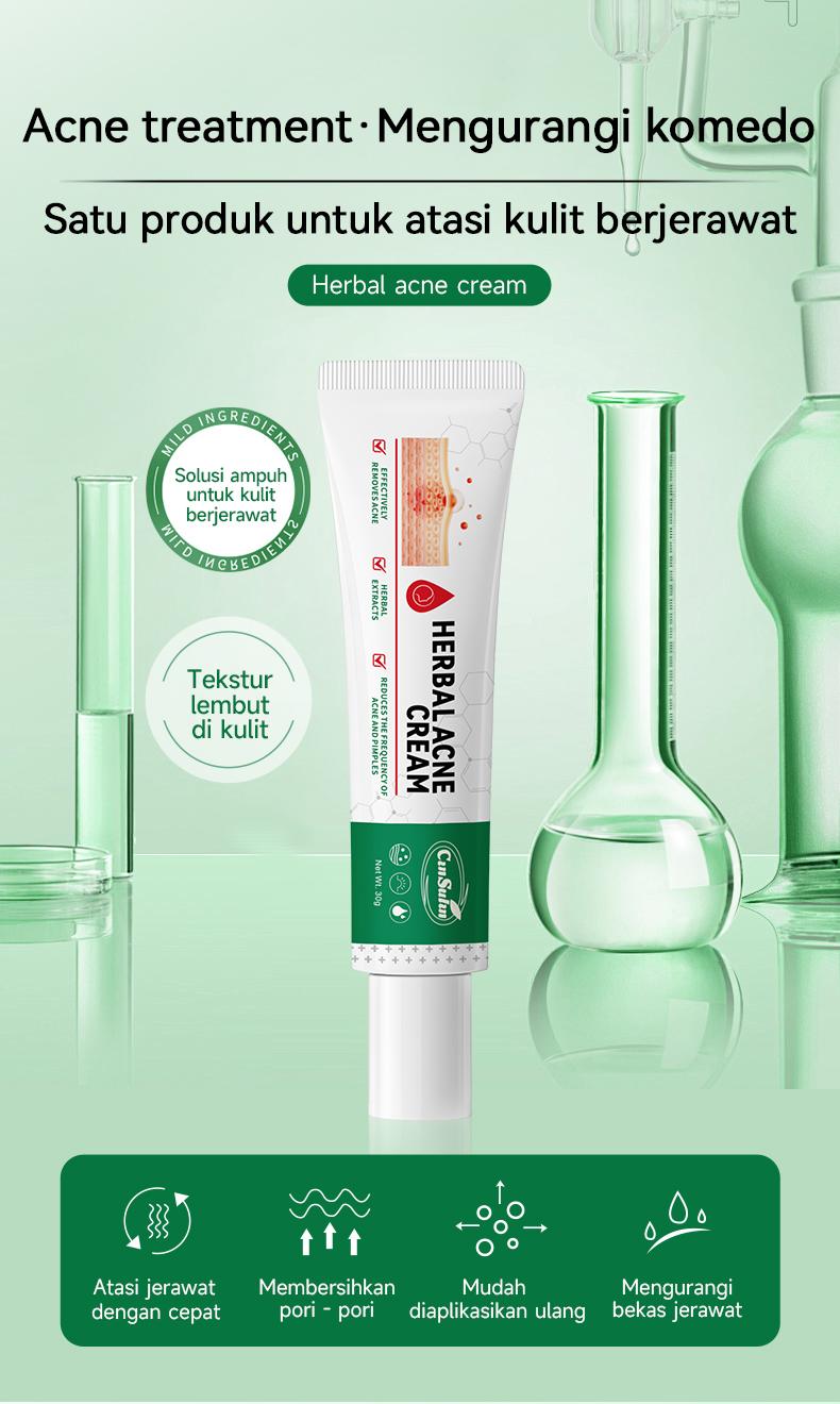 Product Introduction of （T1）BPOM.Beli 2 Gratis 1.Challenge 7 Hari Jerawat Hilang,CINSULIN Obat Jerawat Herbal Ekstrak Alami Cepat Hilangkan Komedo & Jerawat Meradang  BPOM Certified  Aman untuk Remaja & Kulit Sensitif Berjerawat Wajah Gatal Beruntusan 0