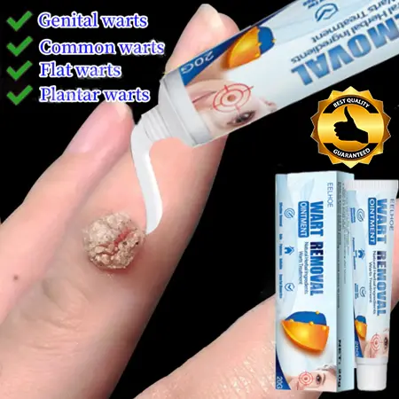 Salep Obat Kutil Paling Wart Removal Cream Penghilang Tahi Lalat Krim Penghilang Lalat Krim Penghilang Kutil Wart Remover Ointment Skin Tag Remover Menghilangkan Kutil Tahi Lalat Mata Ikan