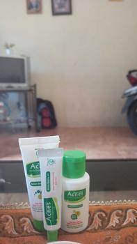 Product Review of NEW Acnes Starter Pack Acnes Treatment Series 3 Items from s**e 0
