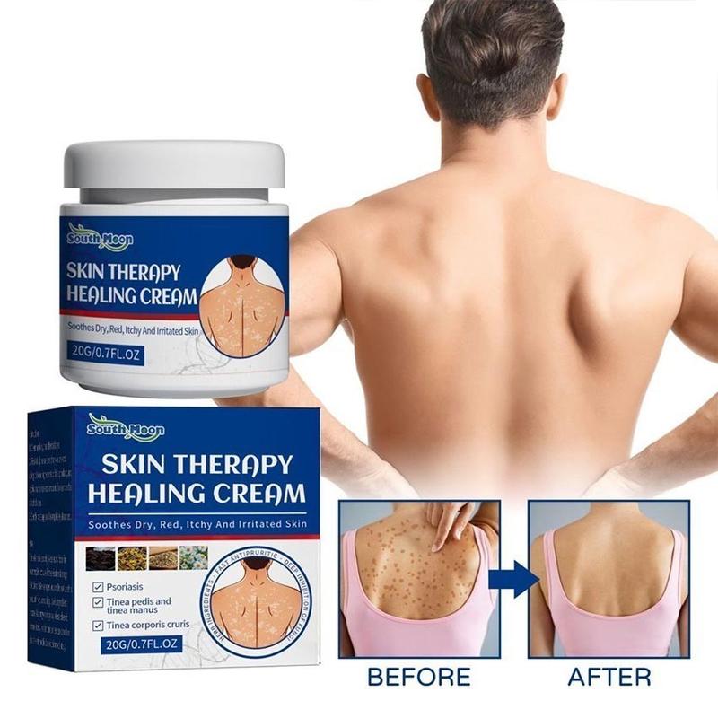 Product Introduction of South Moon Salep Khusus Psoriasis - psoriasis ointment - Kurap Pada Kulit Kepala - Kutu Air - Kurap Pada Badan - Eksim - Infeksi Kulit - Obat Luar Mengatasi Gatal 20g Perawatan Tubuh Kering Pembersihan 5