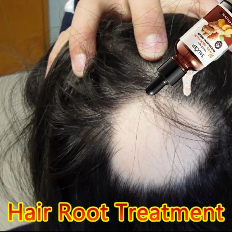 Sadoer serum penumbuh rambut botak dan rontok