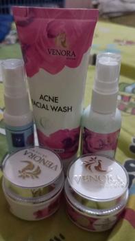 Product Review of PAKET SKINCARE SEMUA JENIS KULIT from m**i 0