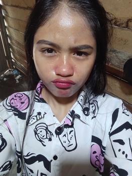 Product Review of [opy] DOSIS 2 - Paket Retinol Booster Cysteamine / Antioxidant from ** 3
