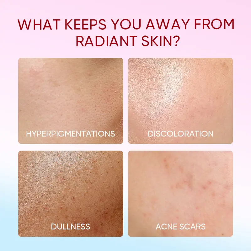 The Originote Brightening Moisturizer - Pelembab dan Mencerahkan Wajah Mengencangkan Muka Pencerah Vitamin Glowing  niacinamide acid skincare dull skin acne jerawat barrier Memutihkan Menerangi kulit kusam smooth Facial day night cream skincare routine 4