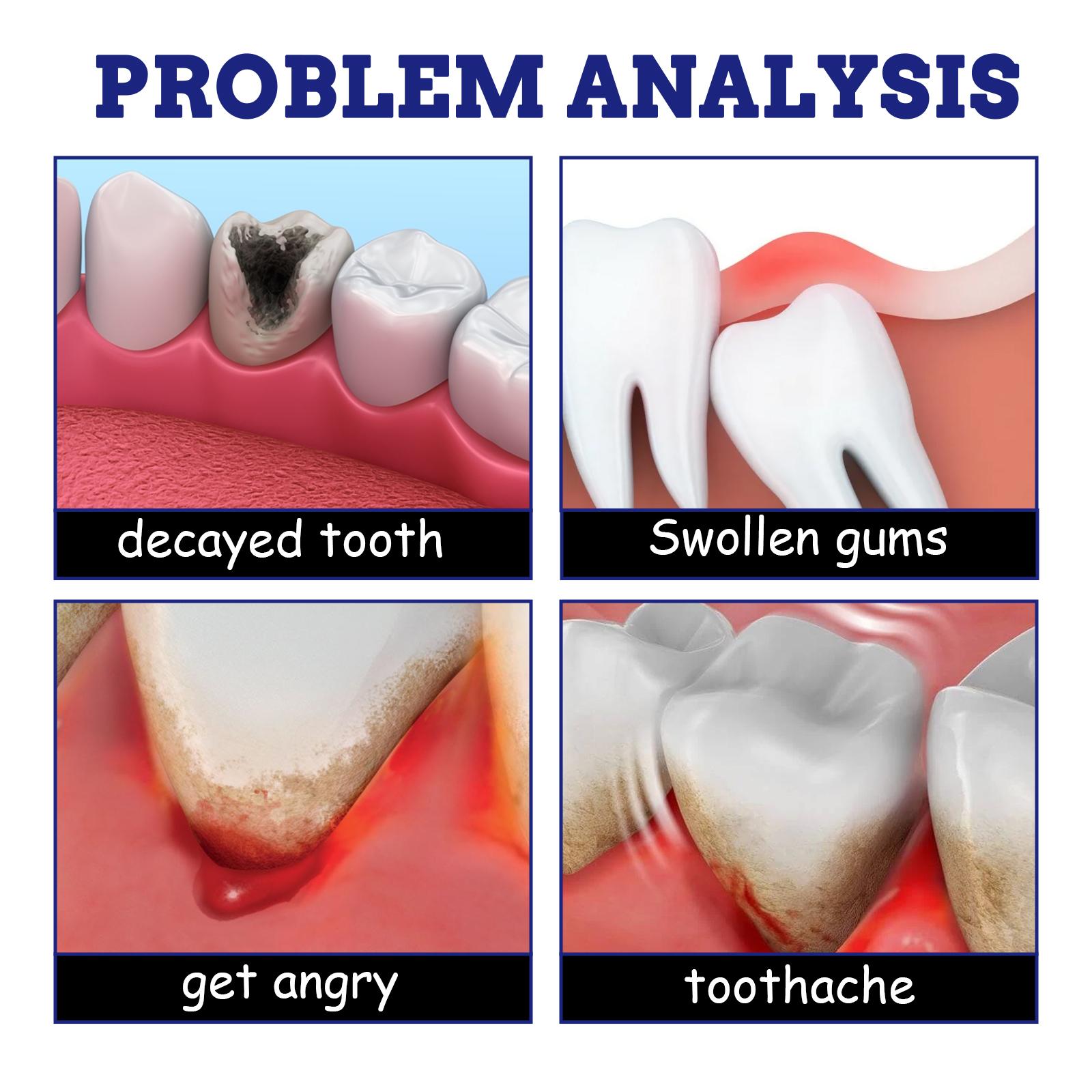 Mulut Segar Tanpa Bau! South Moon Spray Bantu Atasi Gigi Ngilu & Nafas Tak Sedap