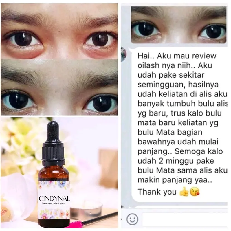 CINDYNAL Oilash Serum Penumbuh Penebal Bulu Mata 4