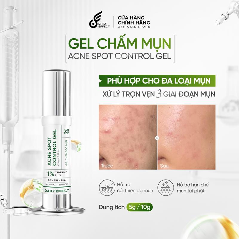   Gel Chấm Mụn Thế Hệ Mới  DAILY EFFECT Acne Spot Control Gel  5g + 10g  