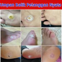 Gambar Plester mata ikan Hilangkan Mata Ikan di Telapak Kaki dan Tangan Penghilang Kutil dan Kapalan - 24 pcs/kantong dari NEXALU Kab. Bogor 5 Tokopedia