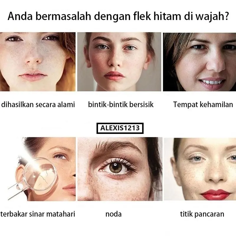 DEVNEN Krim Pemutih Wajah Glowing Cepat Untuk Light Spots Flek Hitam Brighten Skin 20gr Krim Glowing Cepat 【COD】 Memutihkan Mencerahkan Kuning Perawatan 4