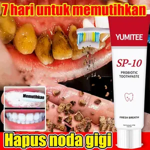 pemutih gigi kuning pasta gigi murah promo pasta gigi tambal gigi permanen pembersih karang gigi pasta gigi sp 10