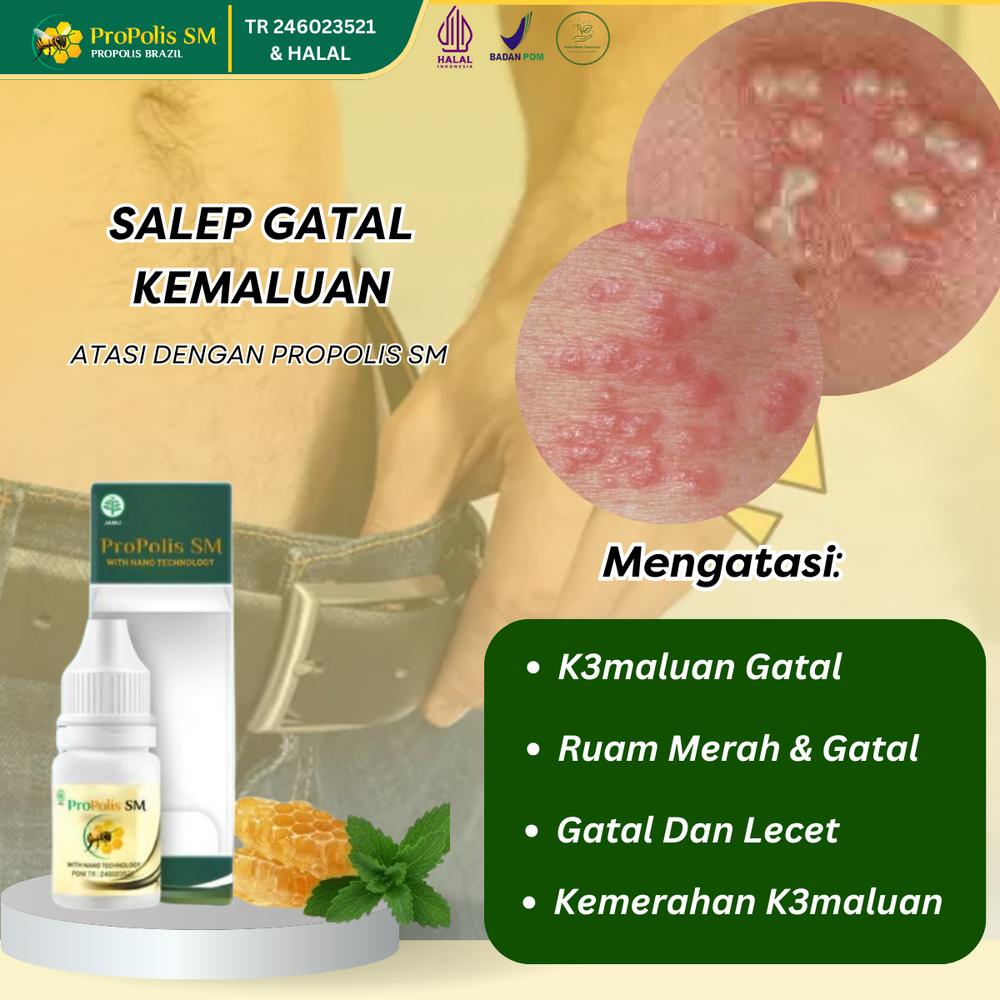Salep Untuk Gatal Kemaluan, Bentol Di K3lamin, Lecet Di K3lamin, Gatal Buah Z4kar, Infeksi K3lamin, Kutil K3lamin, Ruam Merah Di K3maluan Atasi Dengan Propolis SM