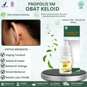 Obat Keloid, Danging Tumbuh, Daging Jadi,Keloid Di Dada, Keloid Di Telinga, Keloid Luka tindik