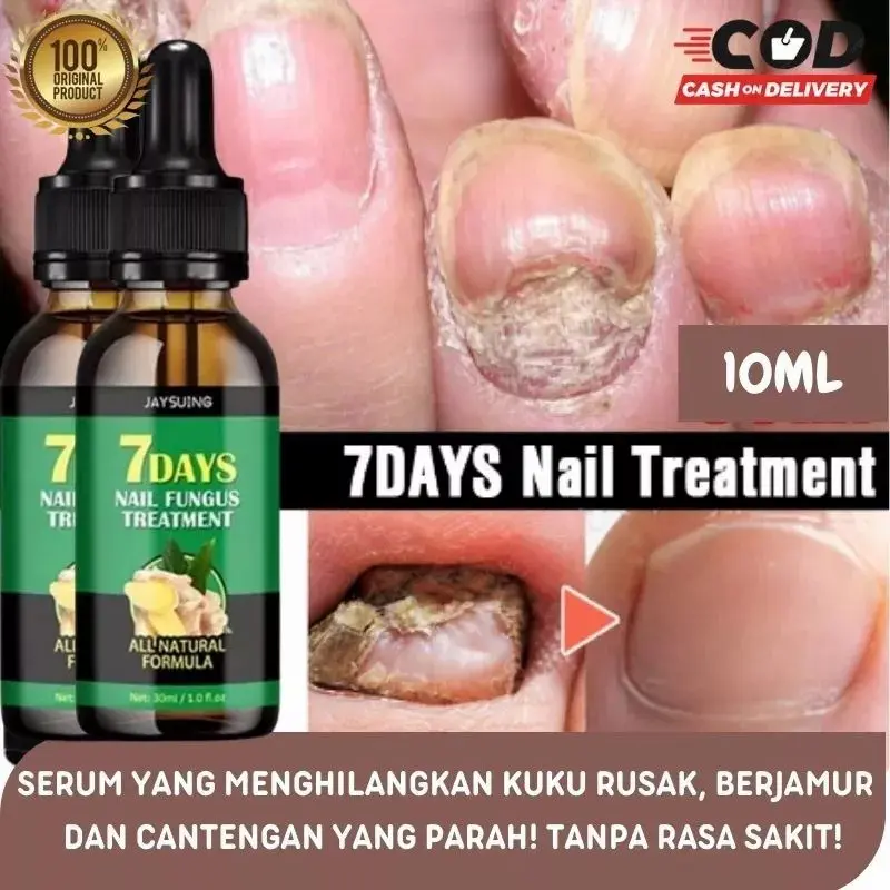 (BISA COD) Nail repair serum perawatan kuku jamur rusak dan cantengan kaki tangan