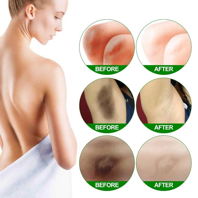 underarm whitening armpit whitening private part whitening 50g butt and inner thigh whitening cream Remove Melanin 5