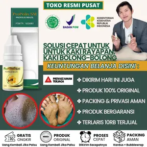 Propolis SM - Solusi Kaki Rayapan dan Bau, Oles Kaki Rayapan, Telapak Kaki Rayapan, Telapak Kaki Bolong, Kaki Korodok